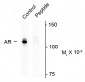 Phospho Ser94 Androgen Receptor (AR) Antibody