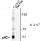 Phospho-Thr269/Ser272 p62 Antibody