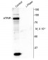 Phospho-Ser239 ATRIP Antibody