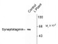 Phospho-Thr202 Synaptotagmin Antibody