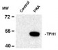 Phospho-Ser58 Tryptophan Hydroxylase 1 Antibody