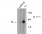 Phospho-Ser31 Tyrosine Hydroxylase Antibody