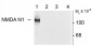 NMDA Receptor, NR1 Subunit, N1 Splice Variant Insert Antibody