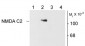 NMDA Receptor, NR1 Subunit, C2 Splice Variant Insert Antibody