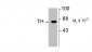 Tyrosine Hydroxylase Antibody