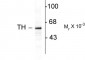 Tyrosine Hydroxylase Antibody