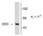 DOPA Decarboxylase Antibody