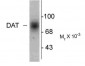 Dopamine Transporter, C-Terminus Antibody