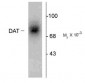 Dopamine Transporter, Extracellular Loop 2 Antibody