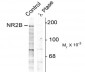 Phospho-Tyr1252 NMDA Receptor NR2B Subunit Antibody