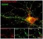 Phospho-Tyr1252 NMDA Receptor NR2B Subunit Antibody