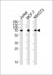 RPS6KB2 Antibody