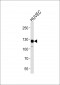 PTK2 Antibody (N-term)