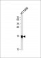 Interferon-inducible protein (IFITM3) Antibody (N-term)