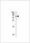 Maspin Antibody (Center)