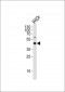 C9orf72 Antibody (C-term)
