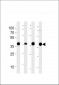 Aldolase (ALDOA) Antibody (N-term)