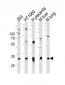 SAR1A Antibody (Center)