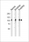 MME Antibody (Center)