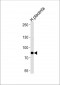 AMPD3 Antibody (Center)