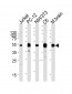 MEK1 (MAP2K1) Antibody (N-term)