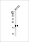 CAV2 Antibody (N-term)