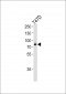 EXT2 Antibody (Center)