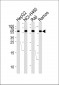 MMP3 Antibody (N-term)