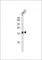 IQCF6 Antibody (N-term)