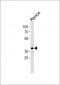 PHF11 Antibody (Center)