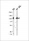 ATP2A1 Antibody (C-term)