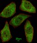 MSRA Antibody (N-term)