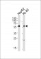 FANCC Antibody (C-term)