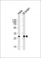 CDK5 Antibody