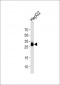 PPT1 Antibody (C-term)