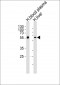 AHSG Antibody (C-term)