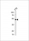 FOXN4 Antibody (N-term)