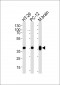 PPP1CB Antibody (C-term)