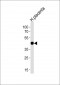 CIR Antibody (C-term)