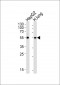 ALDH1A1 Antibody