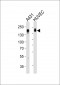 EGFR Antibody (N-term)