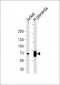 LIMK2 Antibody (C-term)