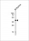 Mouse Tfap2a Antibody (Center)