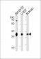 ANP32E Antibody (N-term)