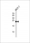 GSTM4 Antibody (N-term)