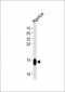 TCL1A Antibody (Center)