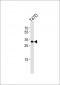 ING4 Antibody (C-term)