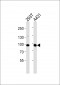 IL4R Antibody (C-term)