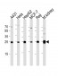 AK4 Antibody (Center)