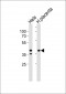 IDH3B Antibody (N-term)